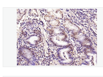 Anti-phospho-Smad3- 磷酸化细胞信号转导分子SMAD3抗体