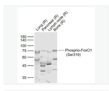 Anti-Phospho-FoxO1- 磷酸化叉头蛋白家族1(Ser319)抗体