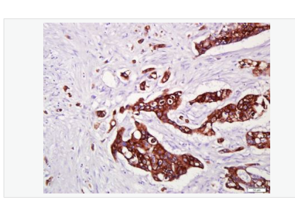 Anti-CK16 antibody- 细胞角蛋白16单克隆抗体