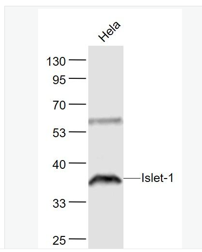 Anti-Islet-1 antibody- 胰岛素基因增强结合蛋白1抗体