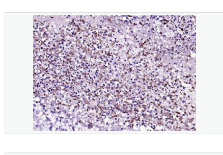 Anti-ANO1/TMEM16A antibody- 跨膜蛋白16A/钙激活氯离子通道单克隆抗体