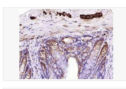 Anti-Calretinin antibody- 钙结合蛋白重组兔单克隆抗体