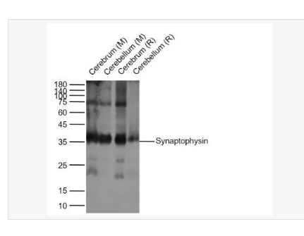 Anti-Synaptophysin antibody- 突触小泡蛋白P38重组兔单克隆抗体