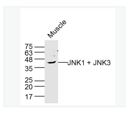 Anti-JNK1 + JNK3 antibody-氨基末端激酶1/3抗体