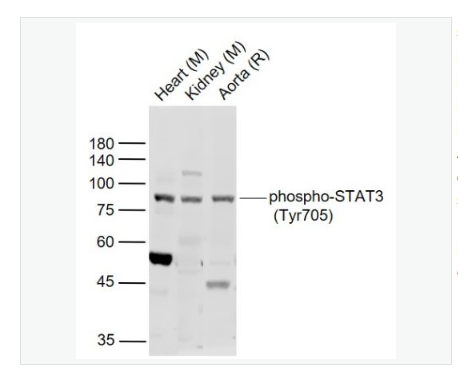 Anti-phospho-STAT3-磷酸化信号转导和转录激活因子3抗体