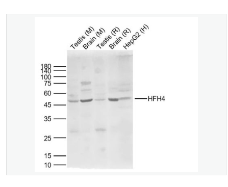 Anti-HFH4 antibody-叉头蛋白J1抗体