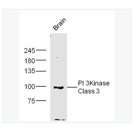 AntiPI 3Kinas Class3 antibody  -磷脂酰肌醇激酶3催化亚单位3抗体