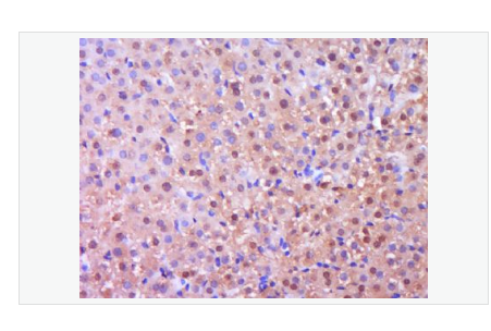 Anti-p75 NGF Receptor antibody -神经生长因子受体抗体