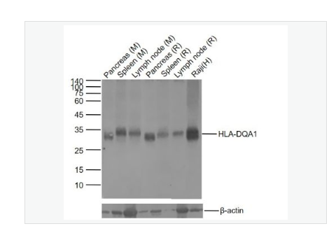 Anti-HLA-DQA1 antibody  -组织相容性抗原DQA1重组兔单克隆抗体