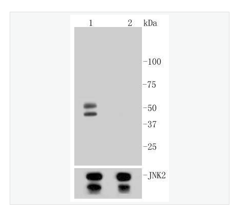 Anti-Phospho-JNK1/2/3 -磷酸化氨基末端激酶1/2/3重组兔单克隆抗体