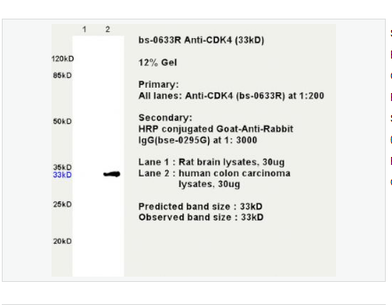 Anti-CDK4 antibody -周期素依赖性激酶4抗体