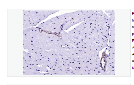Anti-SM22 Alpha antibody-细胞骨架相关蛋白抗体
