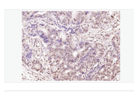Anti-BTG3 antibody-高表达神经上皮蛋白BTG3抗体