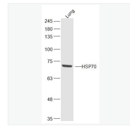Anti-HSP70 antibody-热休克蛋白70抗体