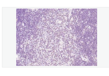 Anti-phospho-TRIM28-磷酸化转录中介因子Tif1β抗体