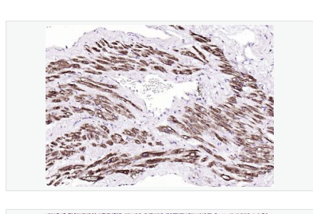 Anti-Fumarase/FH antibody-富马酸水合酶单克隆抗体