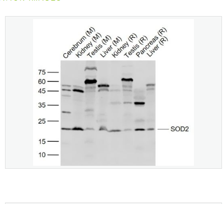 Anti-SOD2 antibody-超氧化物歧化酶2抗体