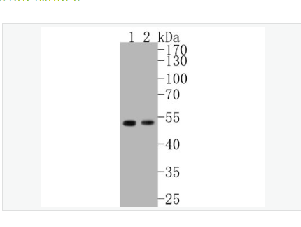 Anti-Cyclin E1 antibody-周期素E重组兔单克隆抗体