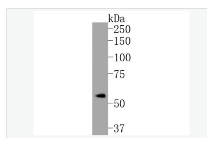 Anti-Phospho-Estrogen -磷酸化雌激素受体ER alpha 重组兔单克隆抗体