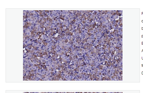 Anti-FGF8 antibody-成纤维细胞生长因子8抗体
