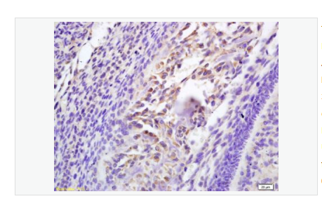 Anti-Galectin 3 antibody -半乳糖凝集素3抗体