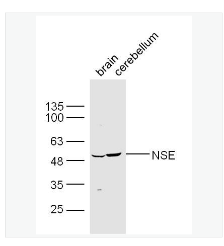 Anti-HMGB1 antibody -神经元特异性烯醇化酶/γ 烯醇化酶抗体