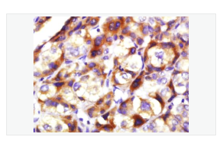 Anti-TIG2 antibody -视黄酸受体应答蛋白2抗体