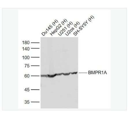 Anti-BMPR1A antibody -骨成型蛋白受体1A抗体