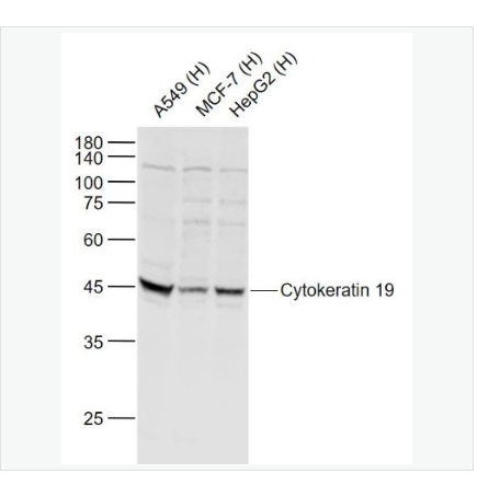 Anti-Cytokeratin 19 antibody-细胞角蛋白19抗体