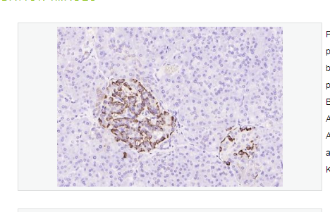 Anti-Glucagon antibody -胰高血糖素抗体