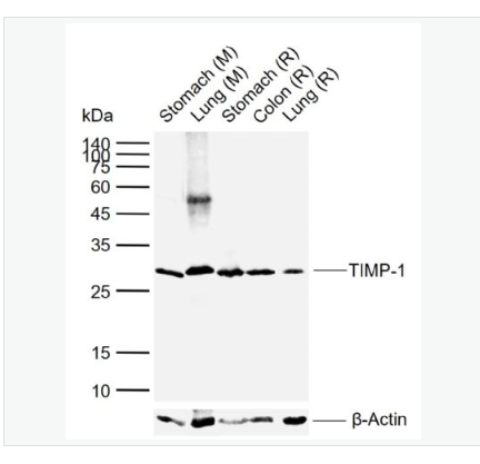 Anti-TIMP-1 antibody-金属蛋白酶组织抑制因子-1单克隆抗体