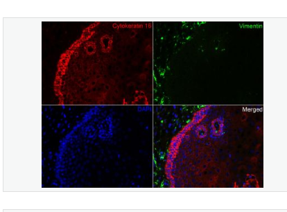 Anti-Cytokeratin 16 antibody-细胞角蛋白16重组兔单克隆抗体