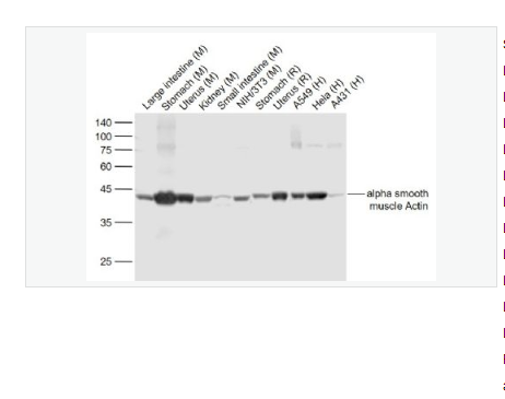 Anti-alpha smooth muscle-SMA重组兔单克隆抗体