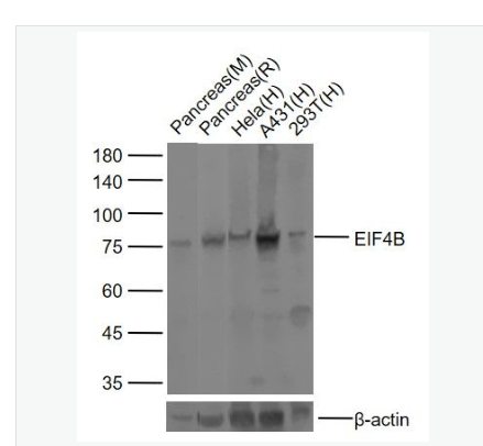 Anti-EIF4B  antibody-真核翻译起始因子4B抗体
