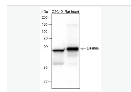 Anti-Desmin antibody-结蛋白重组兔单克隆抗体
