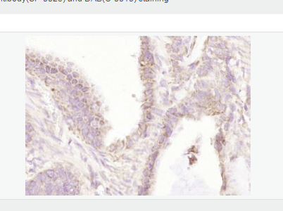 Anti-IFNB1 antibody-干扰素β抗体