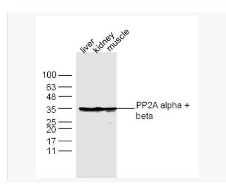 Anti-PP2A alpha + beta antibody-蛋白质磷酸酶-2A抗体