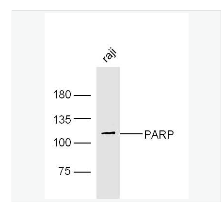 Anti-PARP1 antibody-多腺苷二磷酸多聚酶抗体(N端)