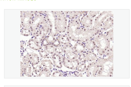 Anti-Thioredoxin antibody -硫氧还蛋白抗体