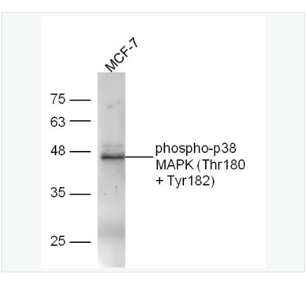 Antiphosphop38MAPK-磷酸化丝裂原活化蛋白激酶p38抗体