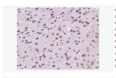 Anti-phospho-IRS1-磷酸化胰岛素受体底物1抗体