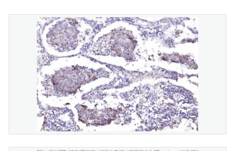 Anti-IKK alpha-KB抑制蛋白激酶α/IKKα/I-κB-α抗体