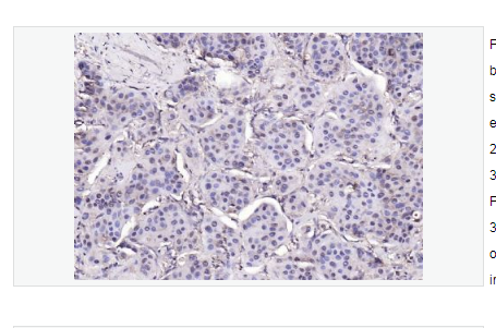Anti-phospho-PYK2-磷酸化富含脯氨酸激酶2抗体