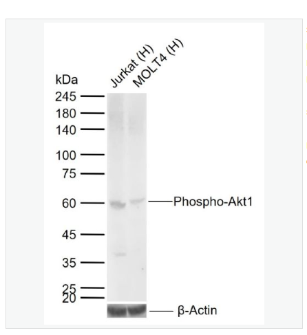 Anti-Phospho-Akt1  antibody -磷酸化Akt1重组兔单克隆抗体