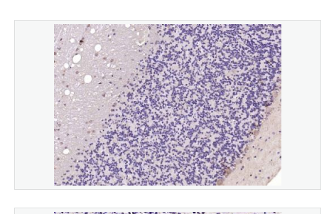 Anti-UBE2Q1 antibody-泛素蛋白连接酶Q1抗体