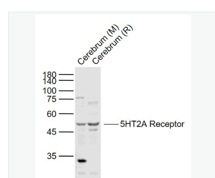 Anti-5HT2A Receptor antibody-5-羟色胺受体2A抗体