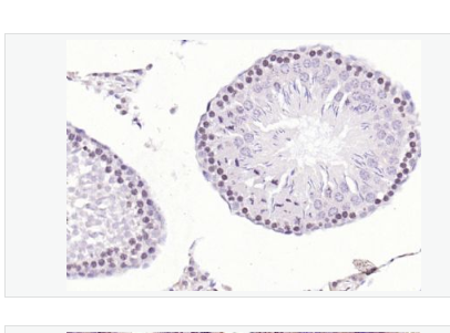 Anti-CDK6 antibody-周期素依赖性激酶6抗体