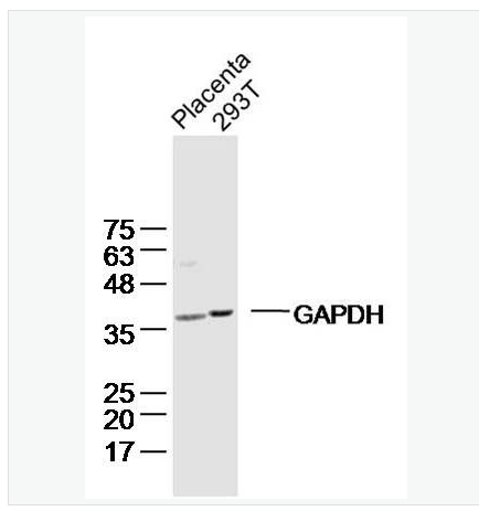 Anti-GAPDH antibody-3-磷酸甘油醛脱氢酶(内参)单克隆抗体