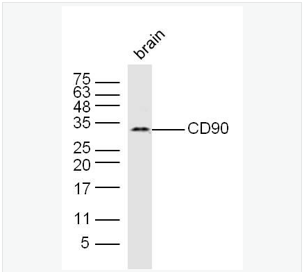 Anti-CD90/Thy-1 antibody-CD90抗体