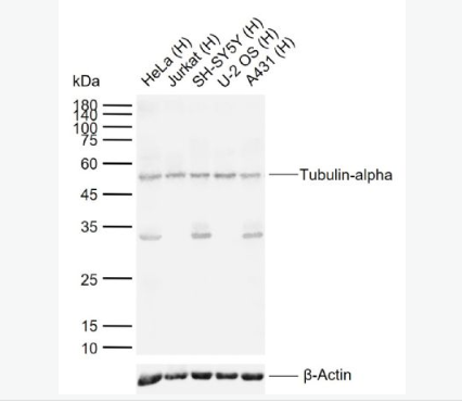 Anti-Tubulin-alpha antibody-微管蛋白α/Tubulin α（内参）抗体